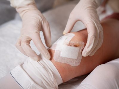 WOUND CARE SERVICES WOUND CARE SERVICES
